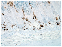 3-nitroY | Nitrotyrosine (25 ĩg) in the group Antibodies Plant/Algal / Environmental Stress / Oxidative stress at Agrisera AB (Antibodies for research) (AS10 706-25)